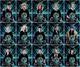 Kakawow Harry Potter 25th Aura Complete 15-card D. A. Assemble! Insert Set (da)